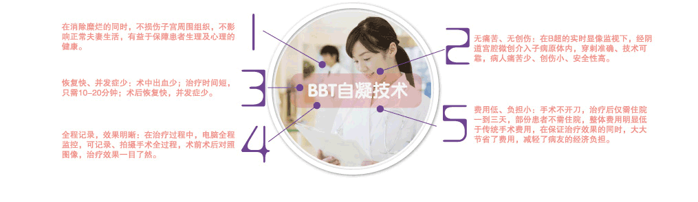 “BBT”自凝技術5大優(yōu)勢
